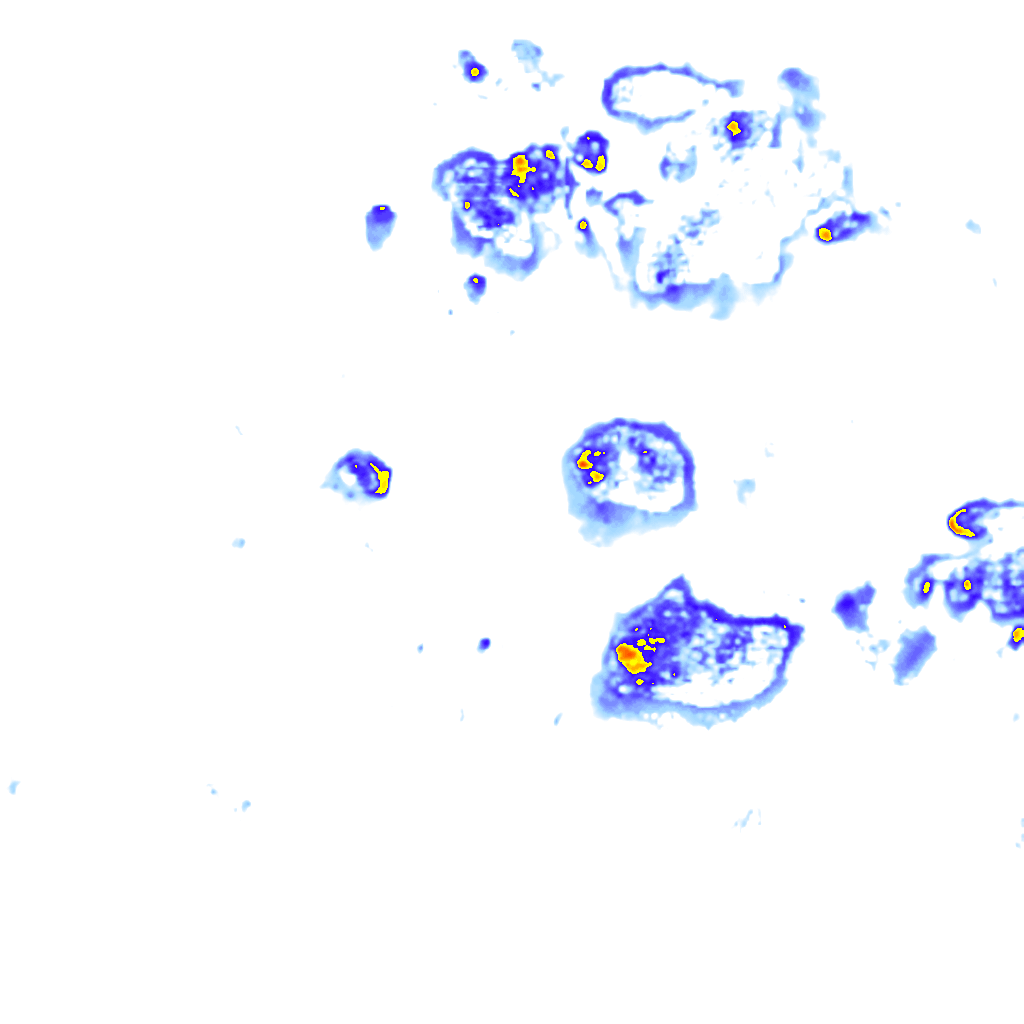 rainLayer