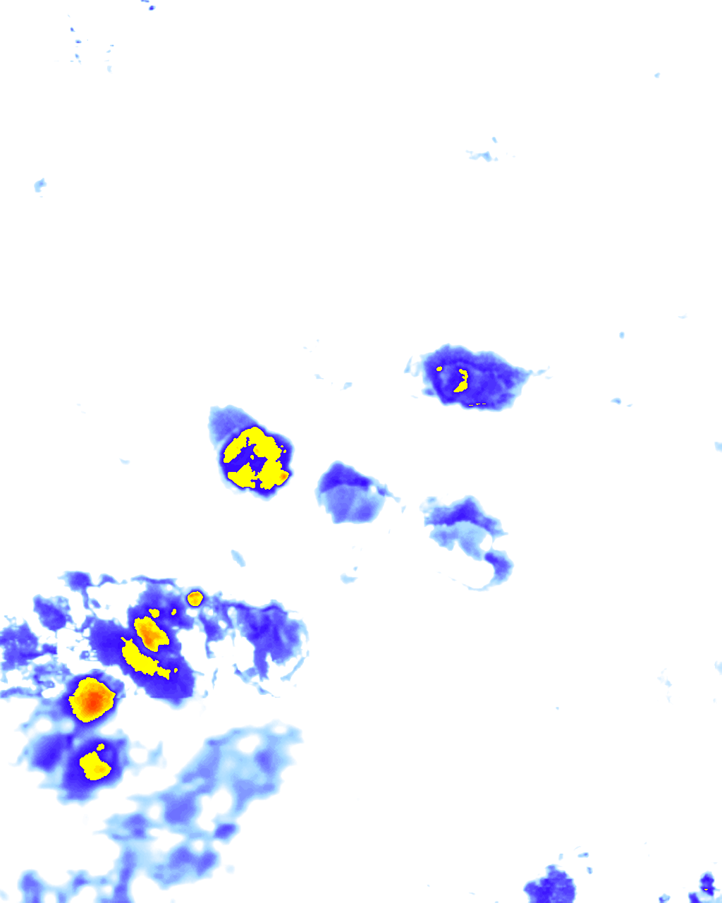 rainLayer