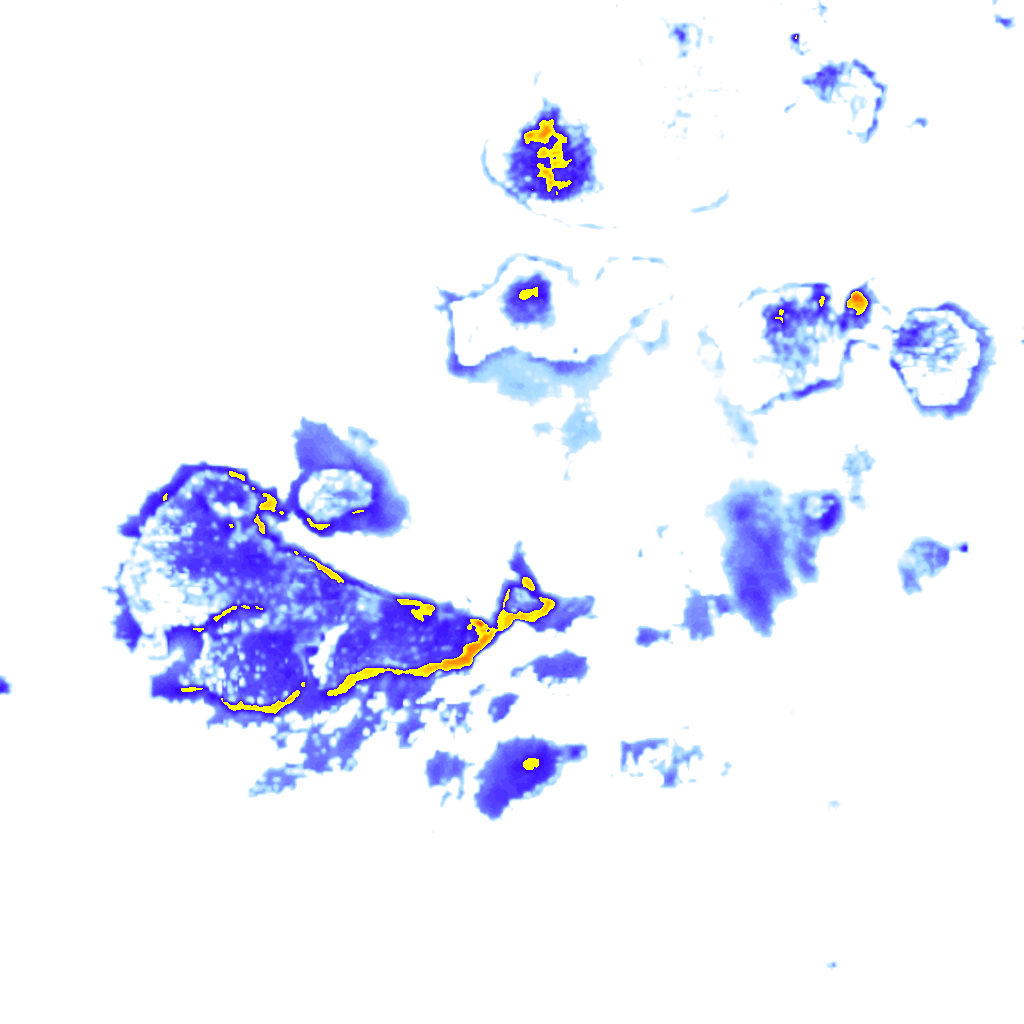 rainLayer