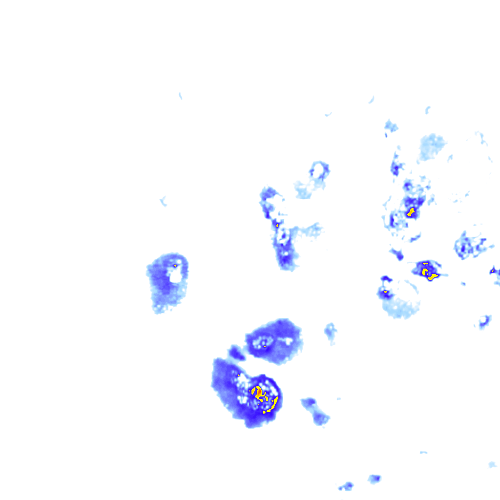 rainLayer