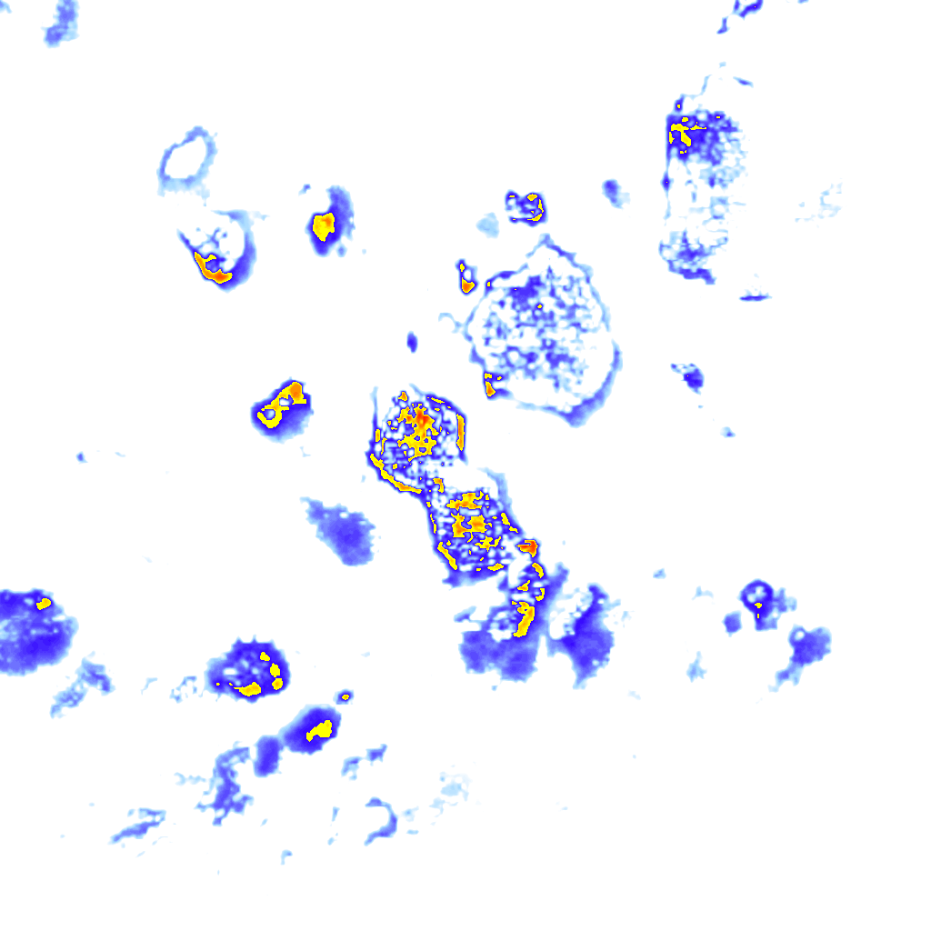rainLayer