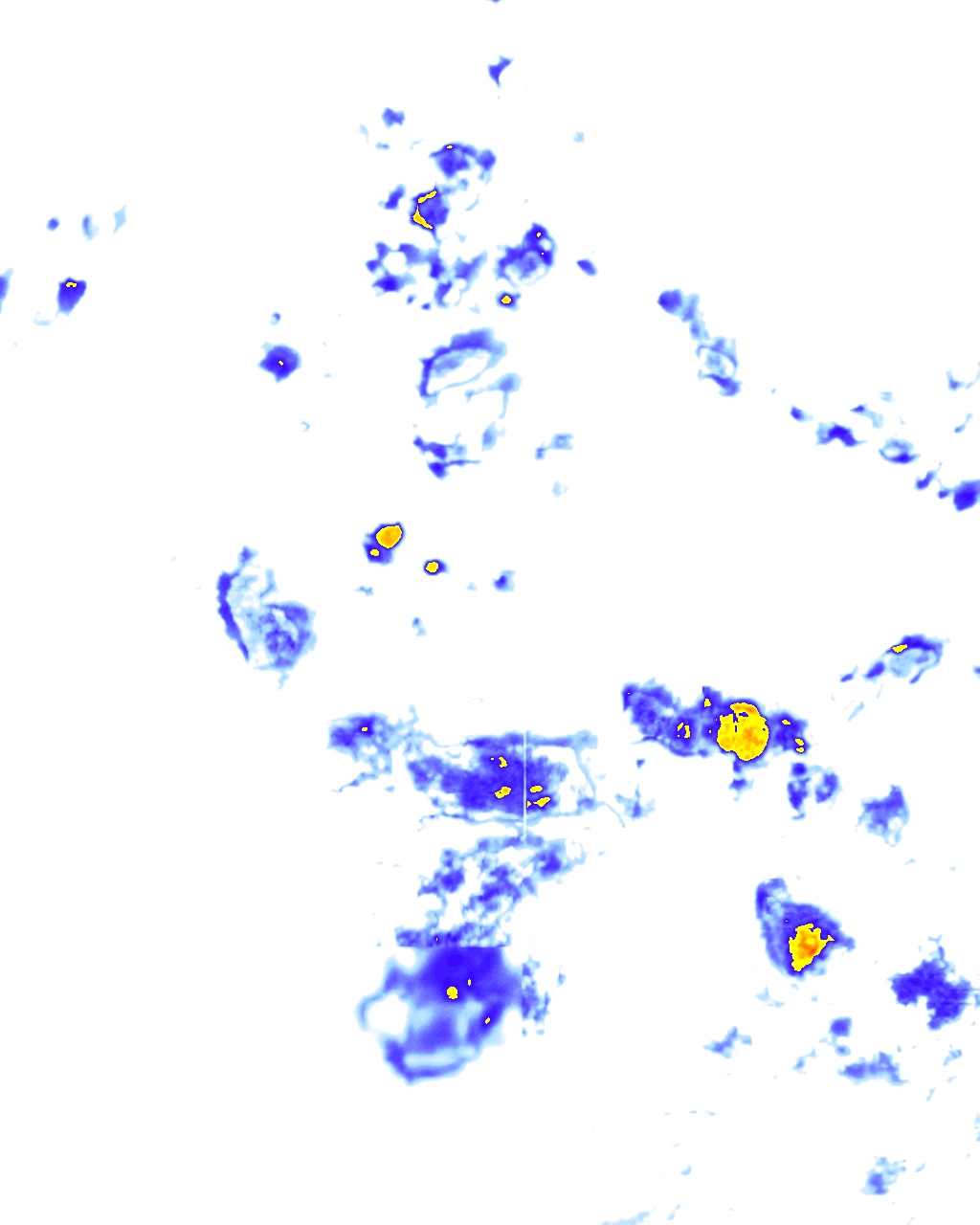 rainLayer