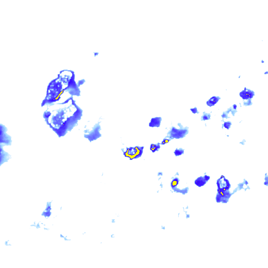 rainLayer