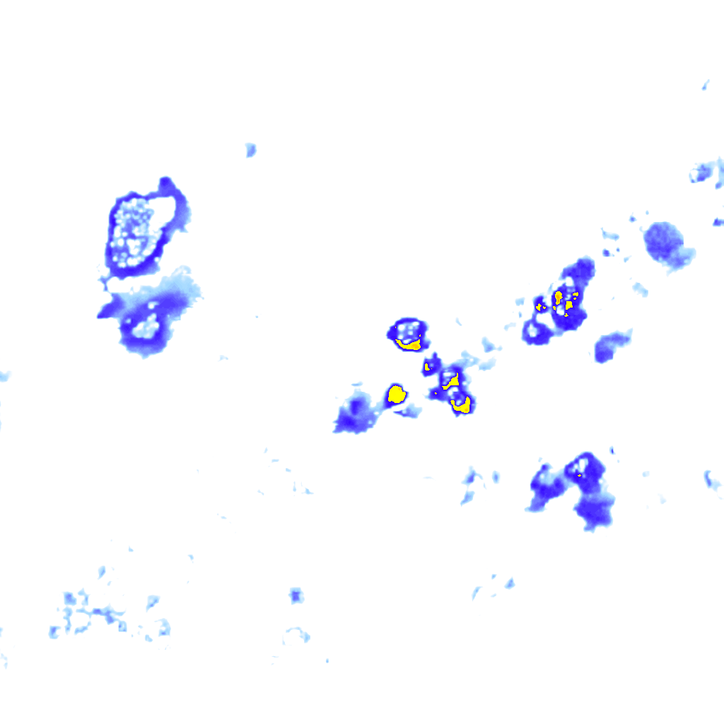 rainLayer