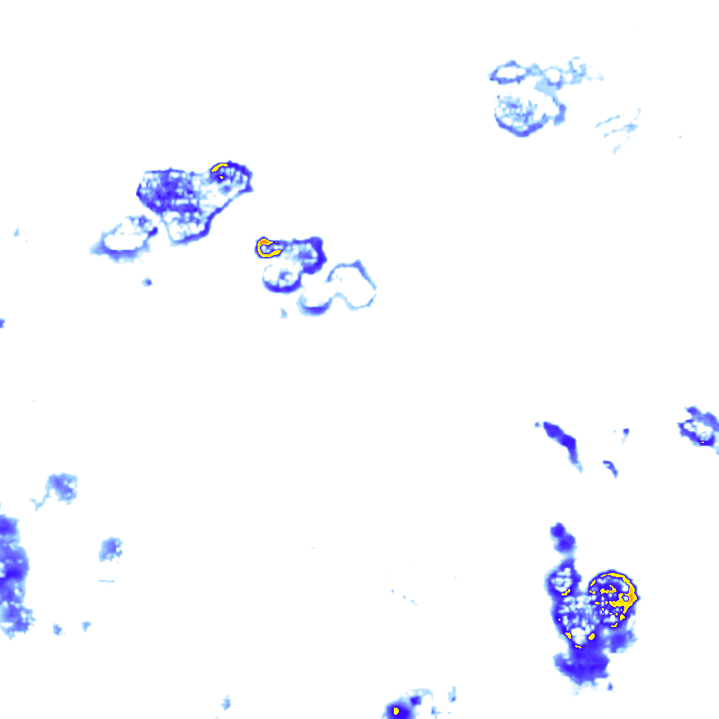 rainLayer