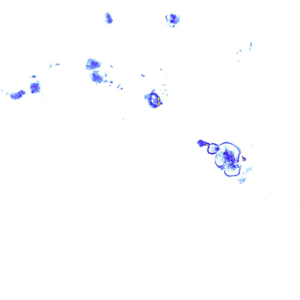 rainLayer