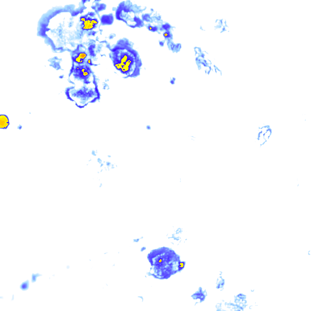 rainLayer