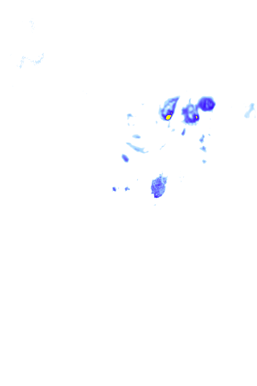 rainLayer