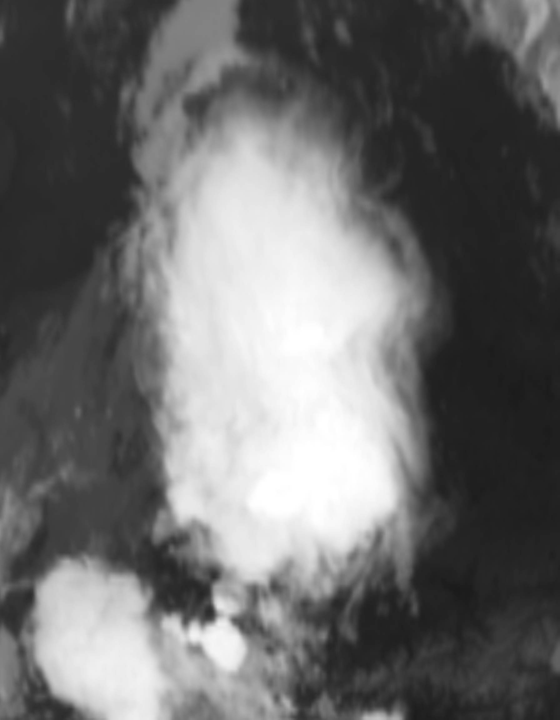 satLayer