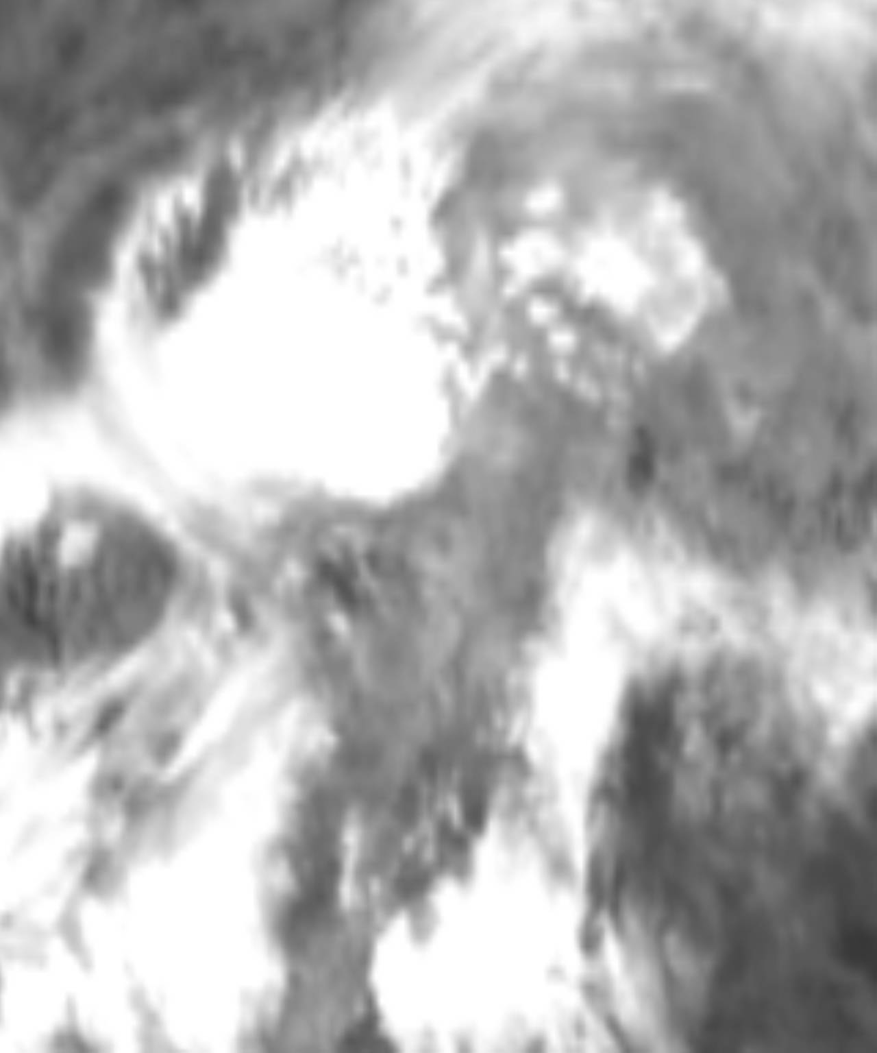 satLayer