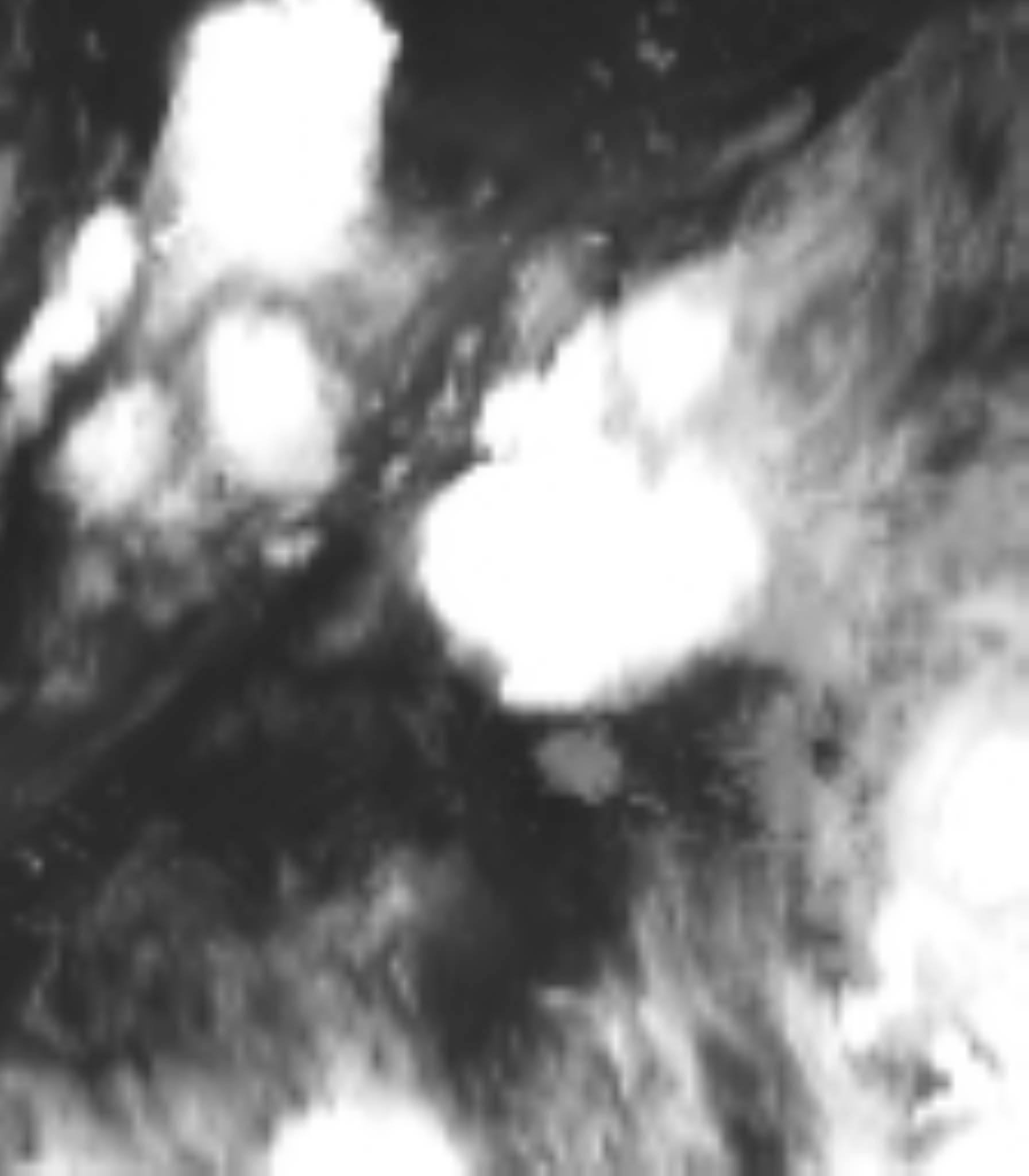 satLayer