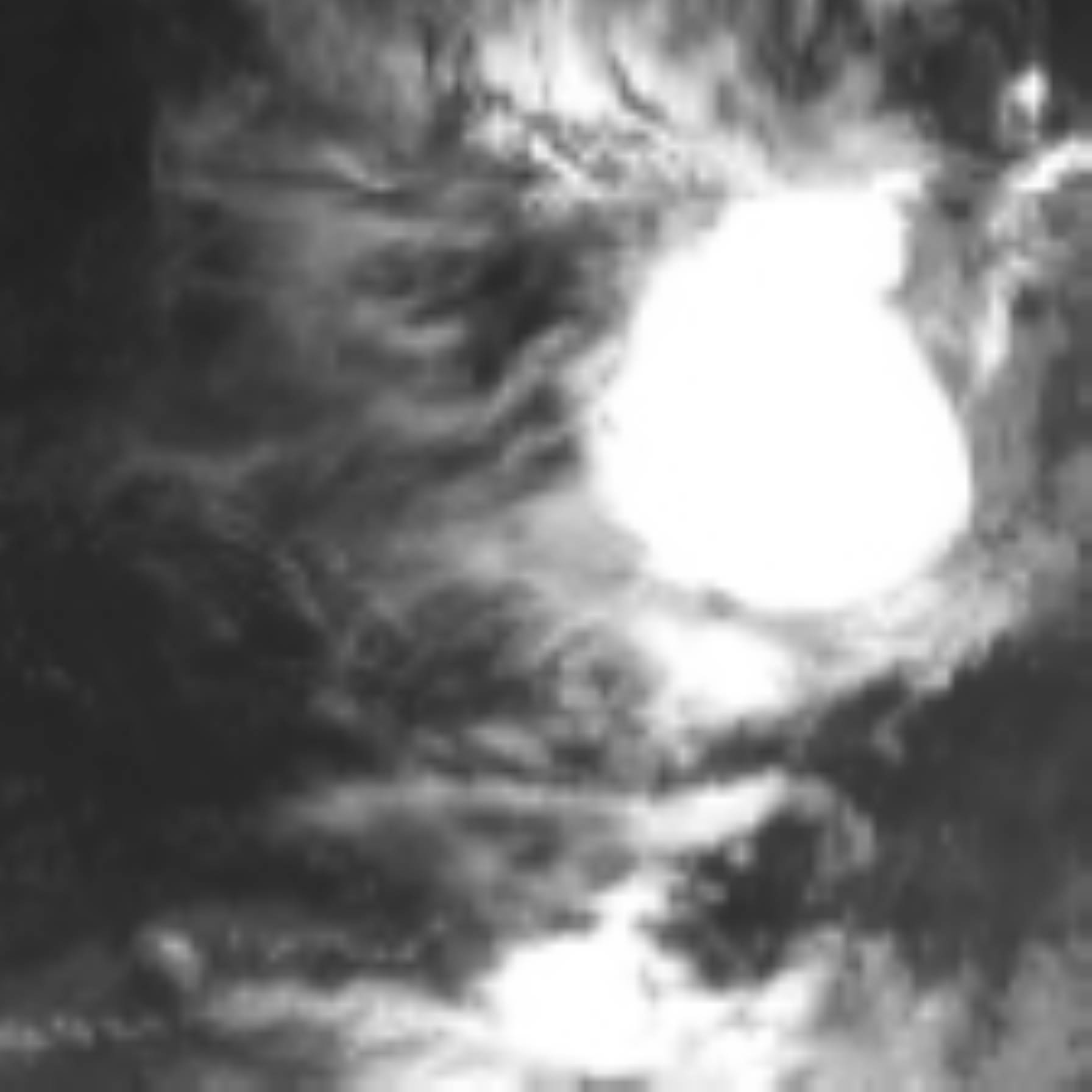 satLayer
