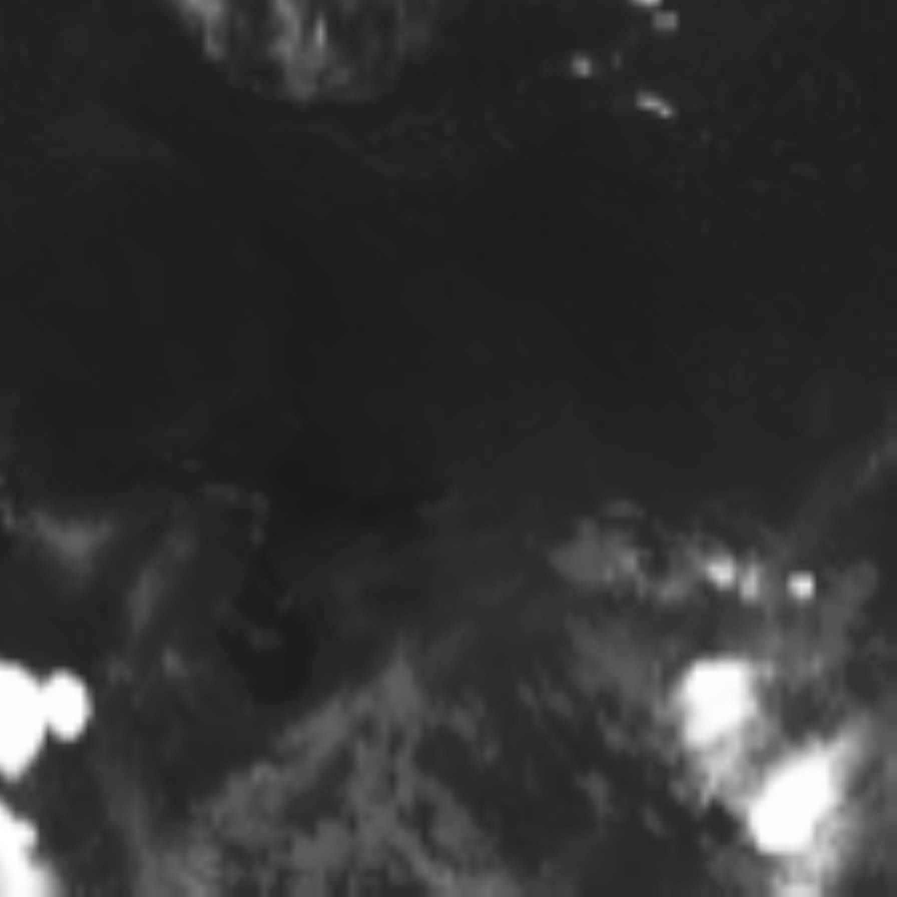 satLayer