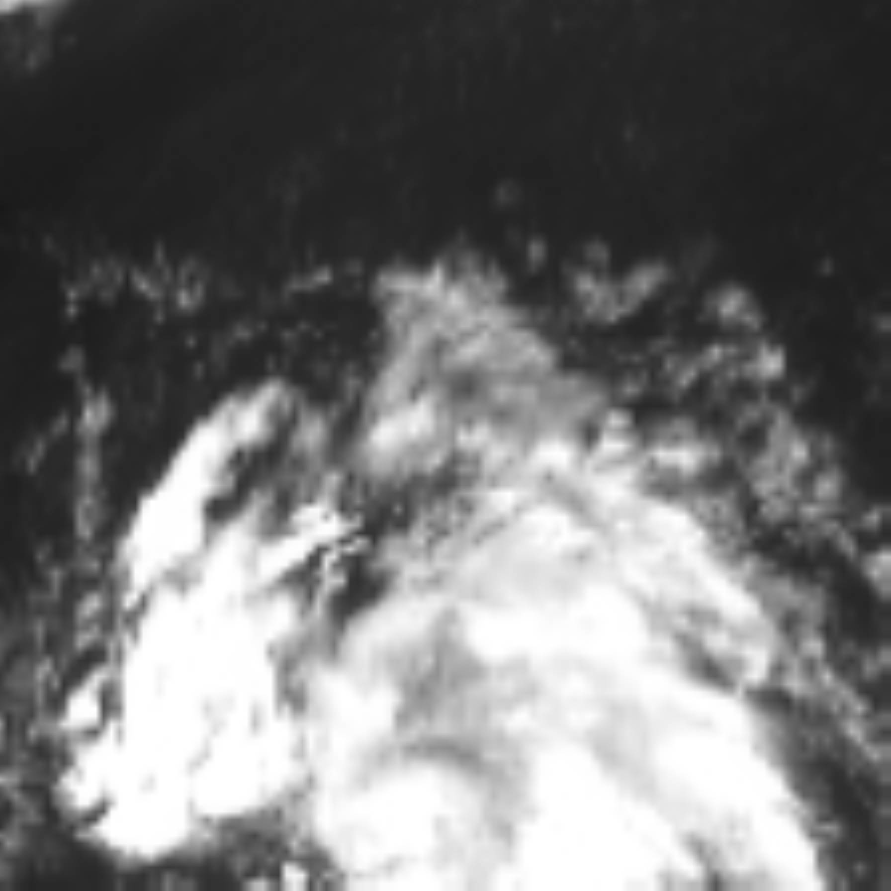 satLayer
