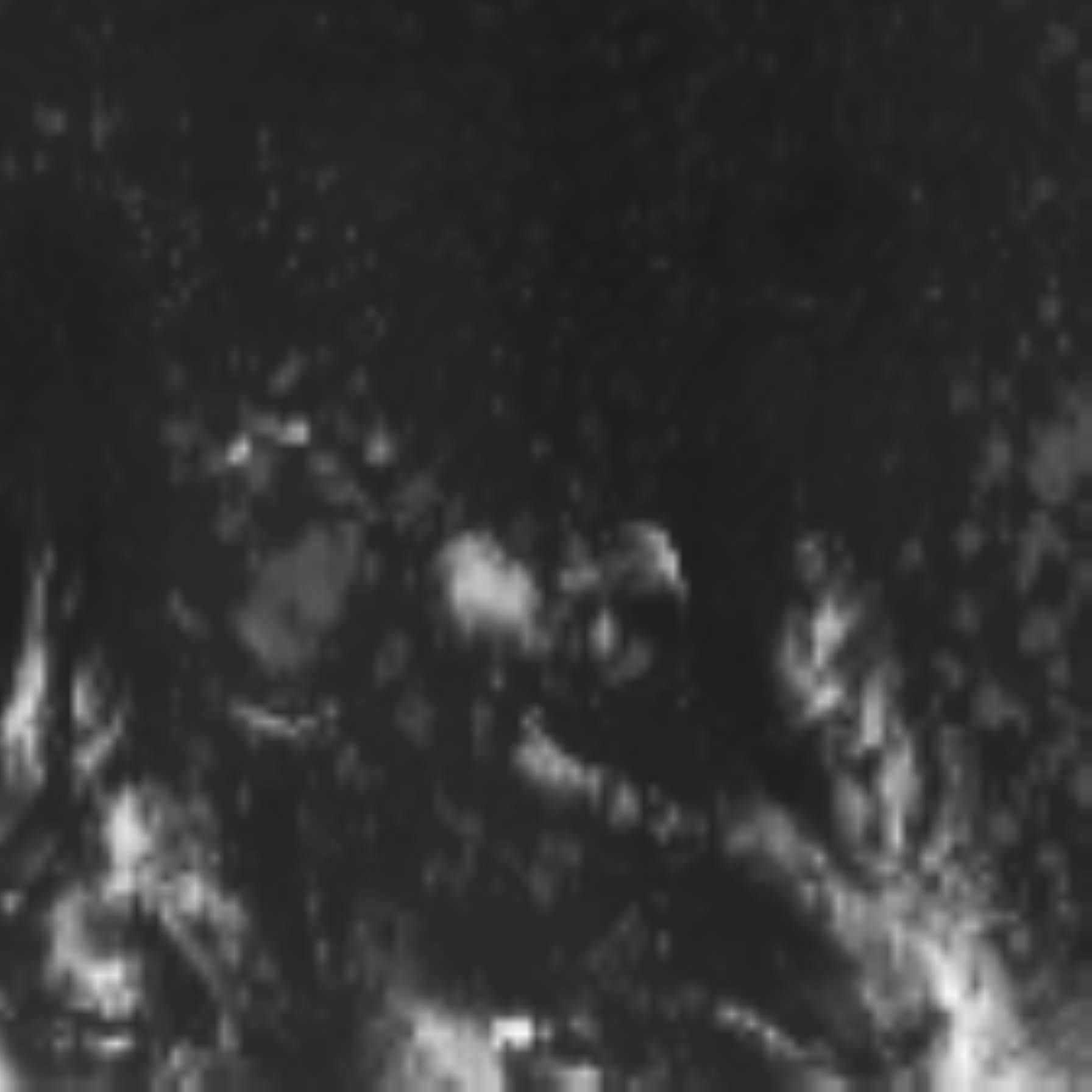 satLayer