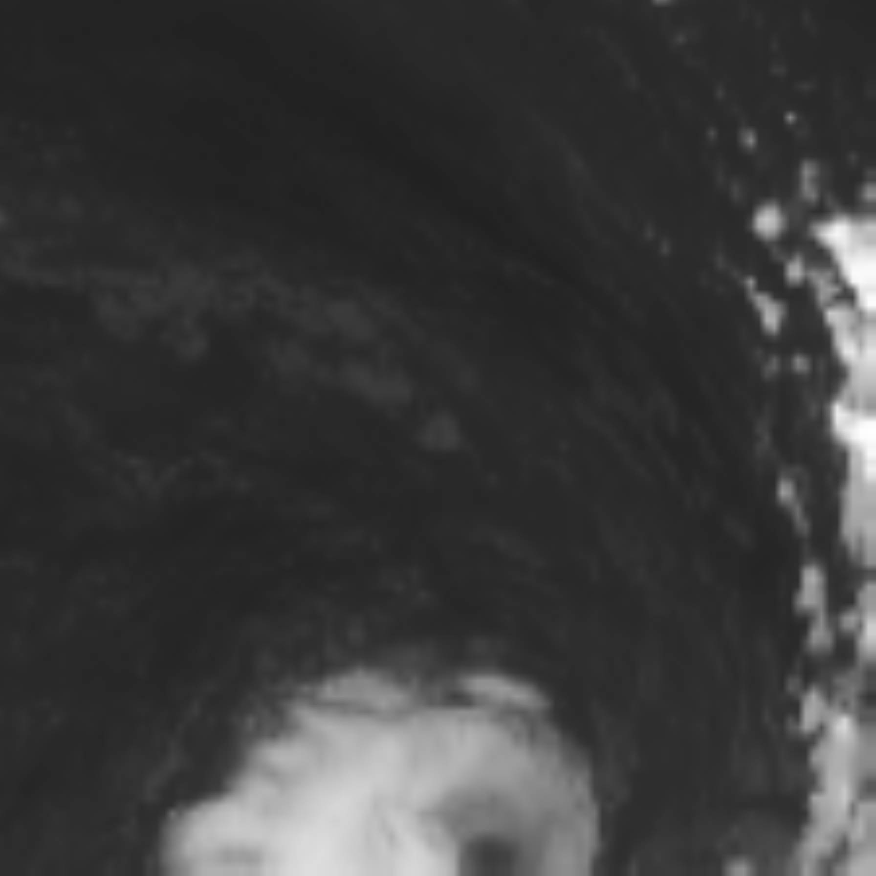 satLayer