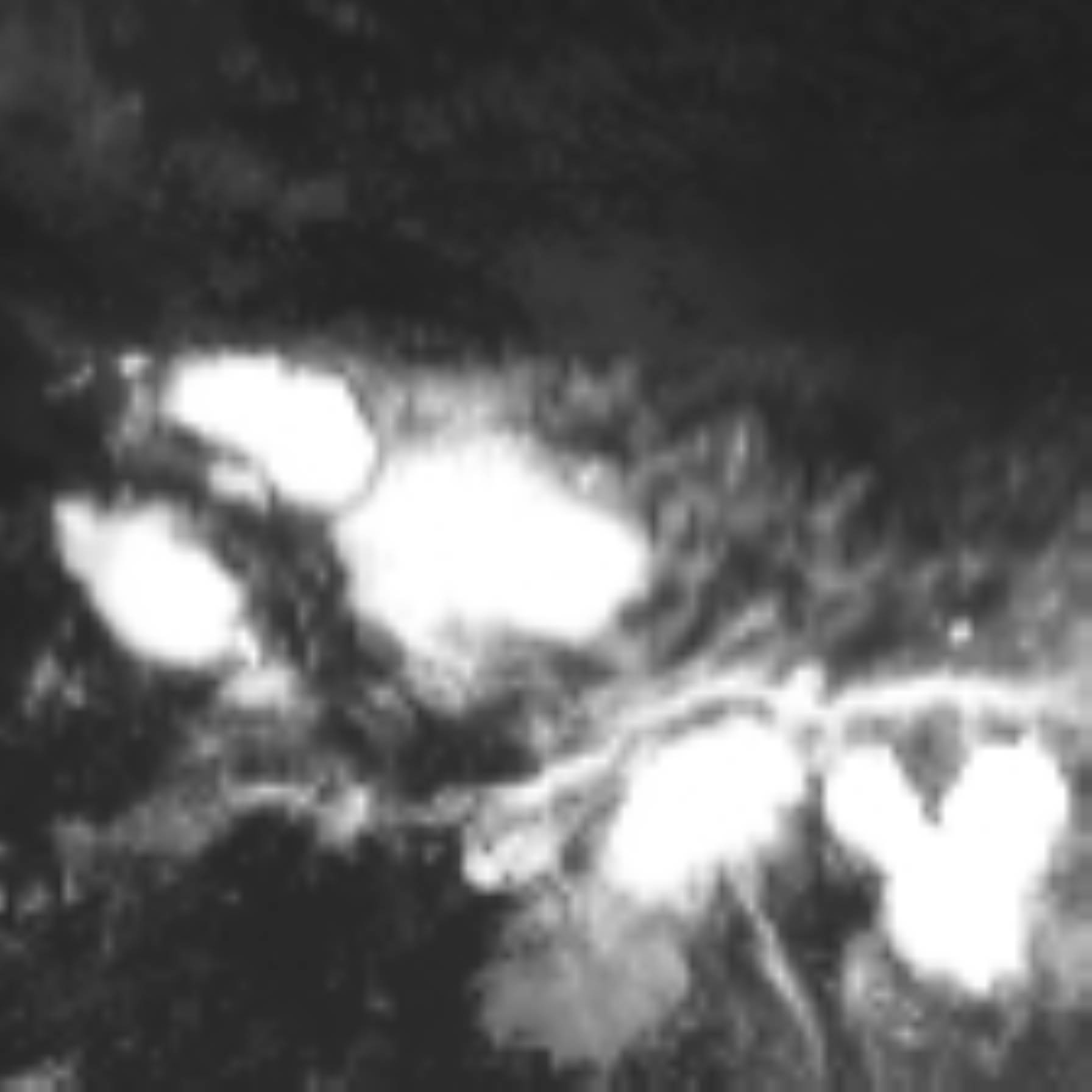 satLayer