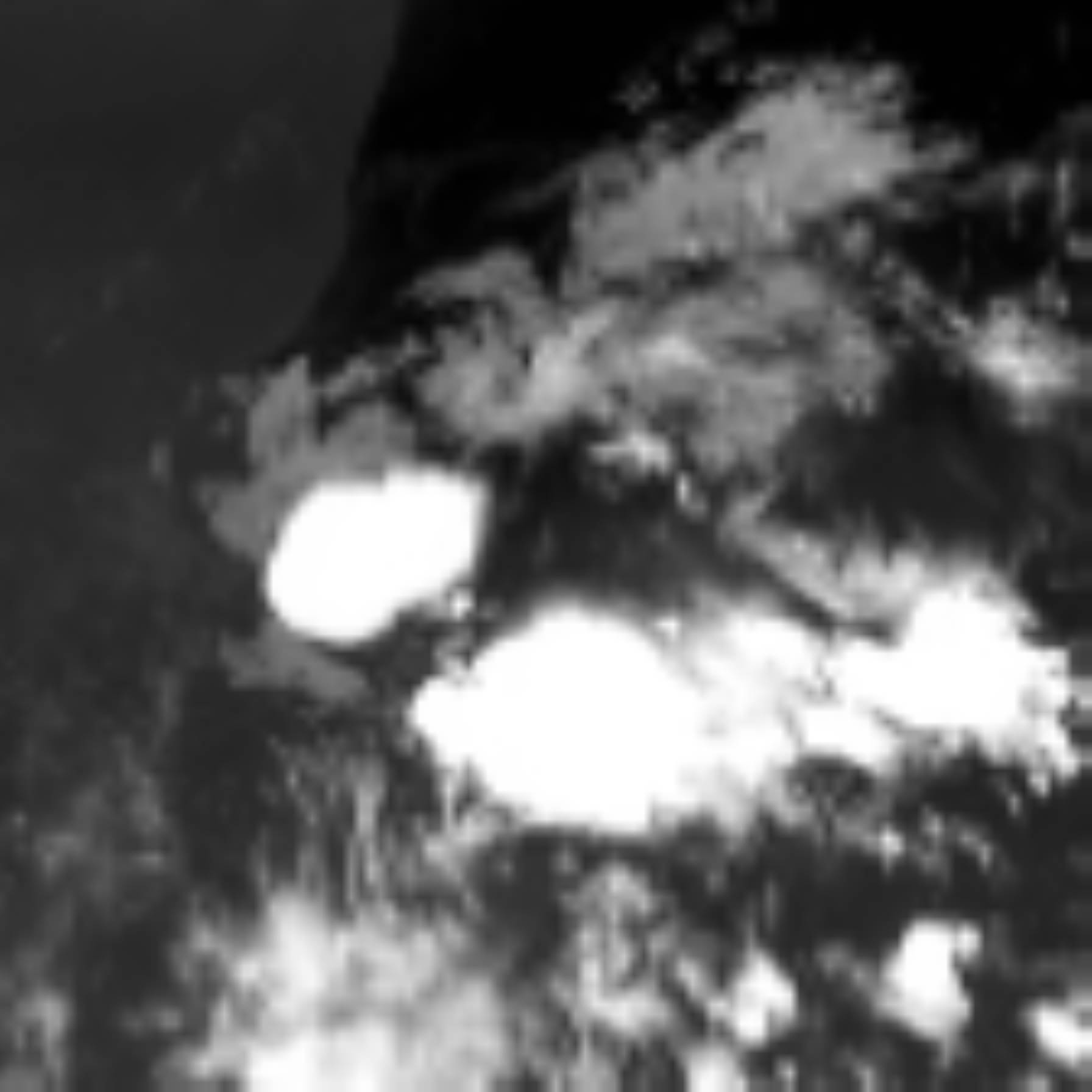 satLayer