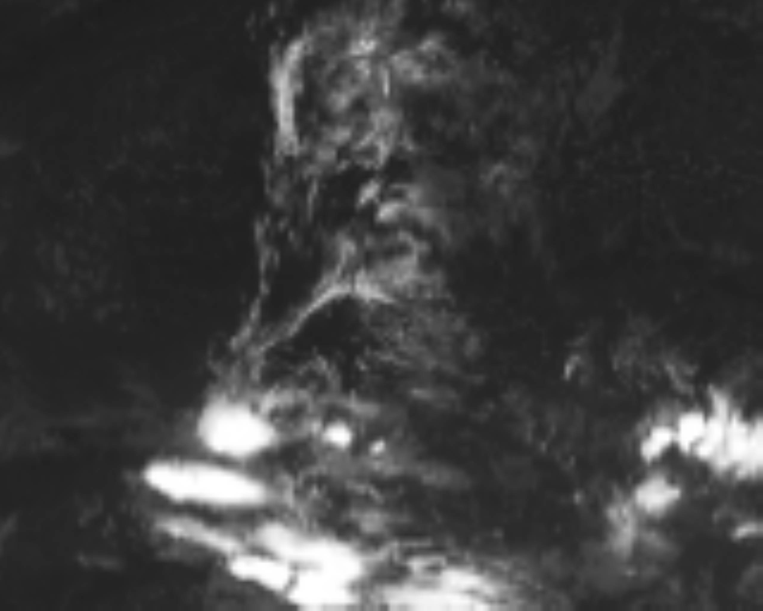satLayer
