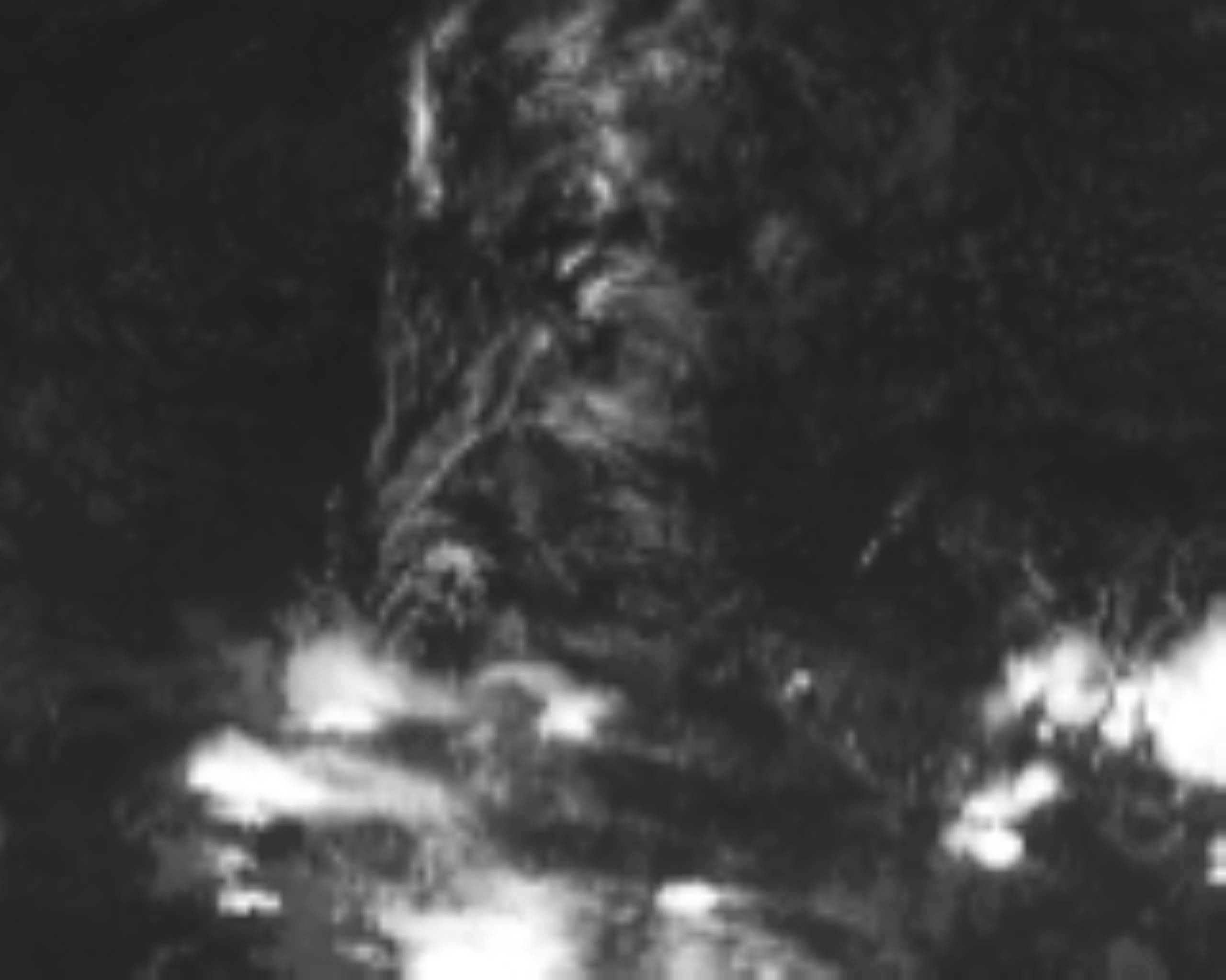satLayer