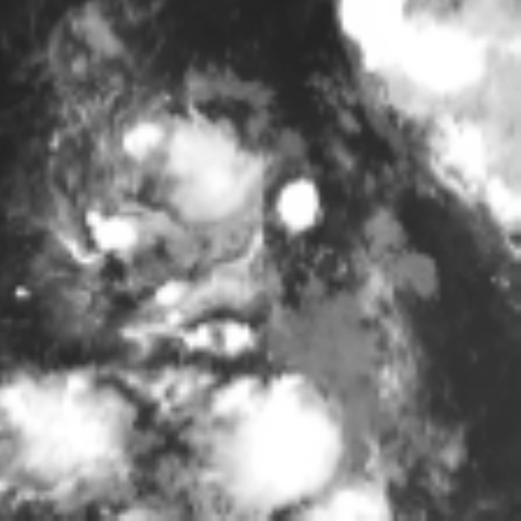 satLayer