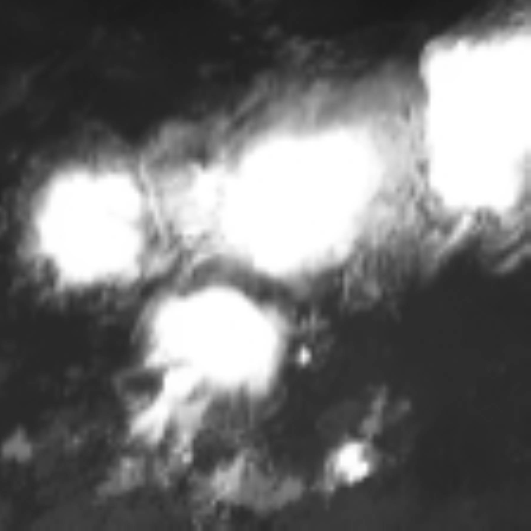 satLayer